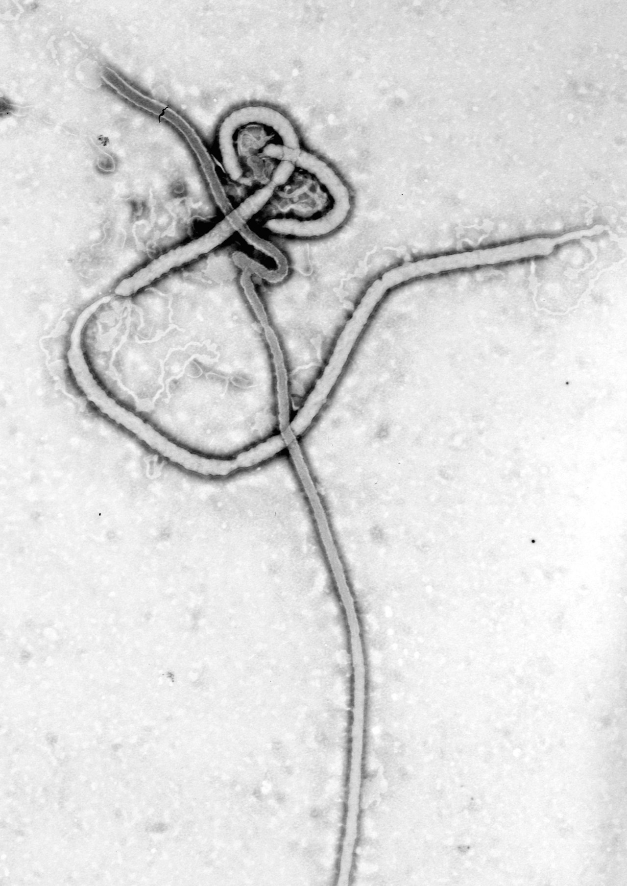 Kongo'da Ebola salgını: Acil durum komitesi ikinci kez toplandı