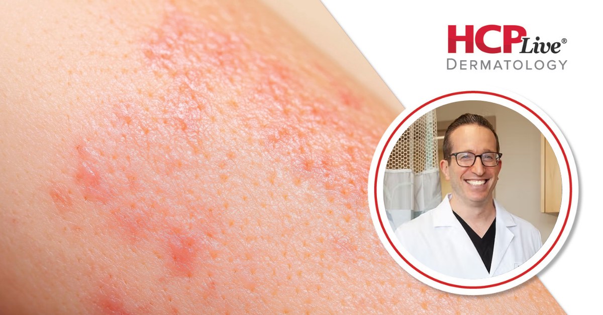Dermatoloji Uzmanları İçin Rekabet, Tükenmişlik ve Her Şeye