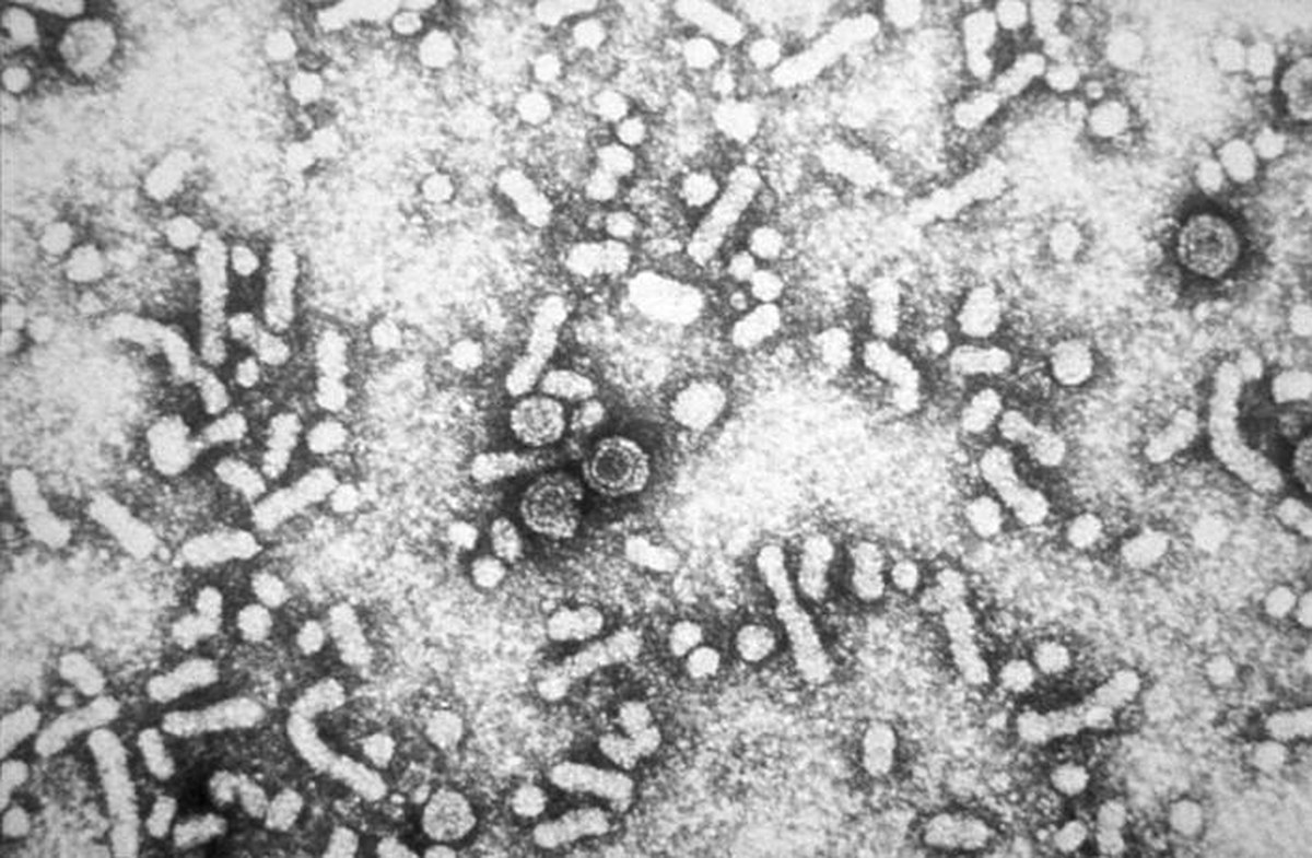 Hepatit B tedavisinde umut: Her 5 kişiden biri tamamen iyileşti