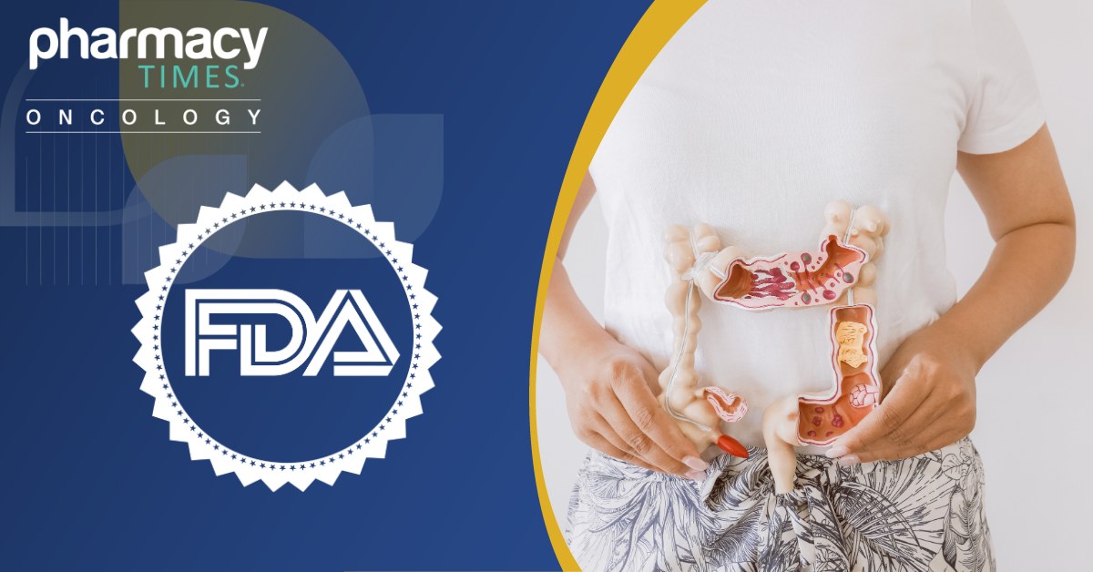 FDA, metastatik kolorektal kanser tedavisinde kullanılan Varsetatug Masetecan'a hızlandırılmış onay süreci başlattı
