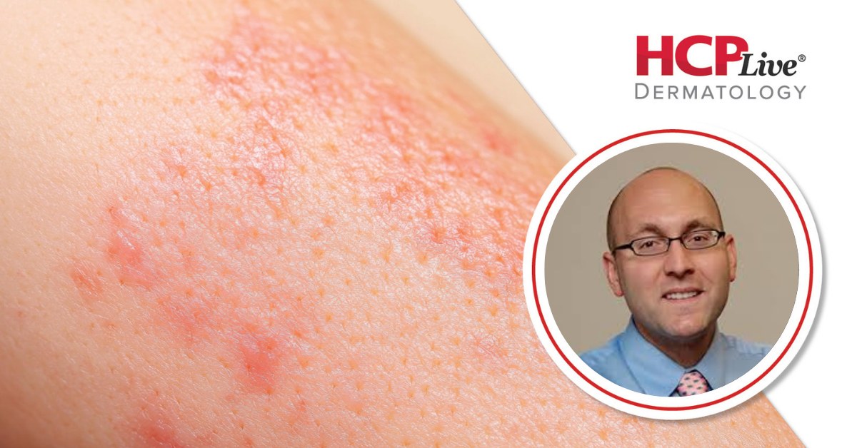 Dermatolojideki Hassas Tıp: İlerlemeler ve Gelecek Perspektifleri