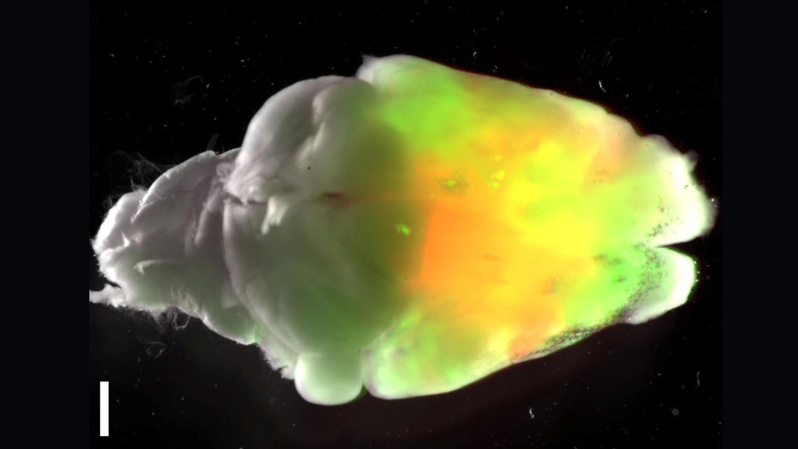 A mouse's brain shown from the top, with one portion highlighted green, orange and yellow