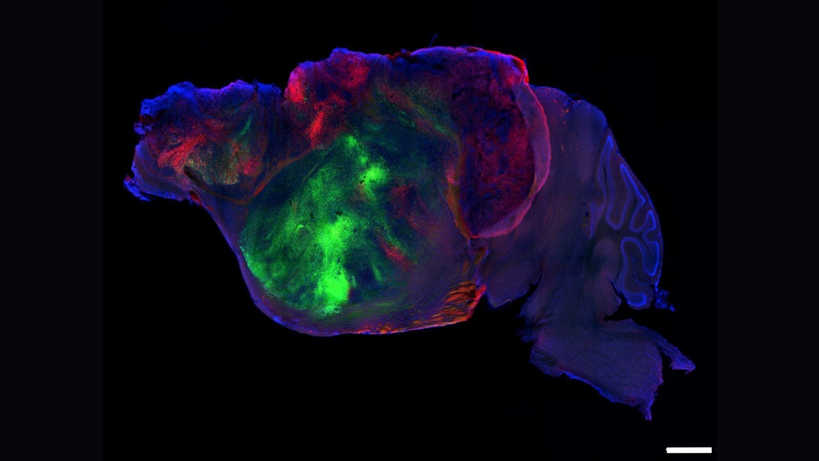 A mouse's brain shown in purple, pink, red and green