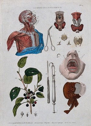Anatomy and botany; top left, dissected head and chest showing arteries; top right, larynx; bottom left, buckthorn plant; centre, surgical instruments; bottom right, electric ray fish. Coloured engrav - Wellcome Tıp Tarihi Kütüphanesi