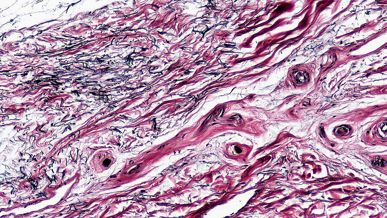 Tissue: Human Protein Atlas (HPA) API - Teknik Mimarisi ve Mühendislik Analizi - Connective Tissue Human Elastic Tissue (40049096890)