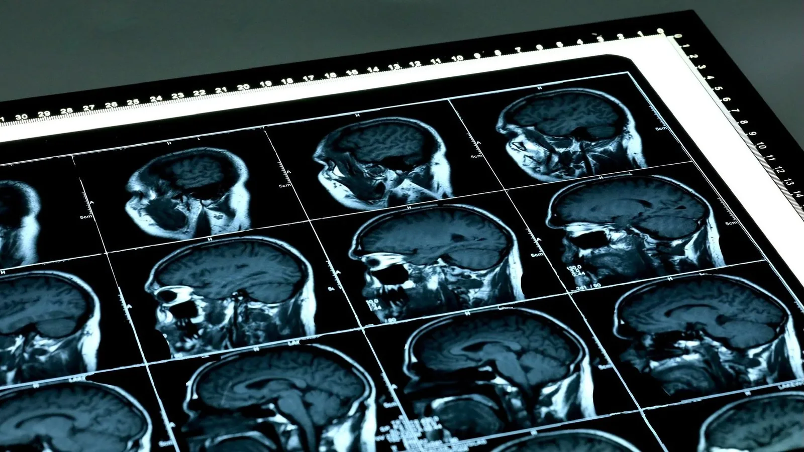 a grid containing many slices of a brain mri